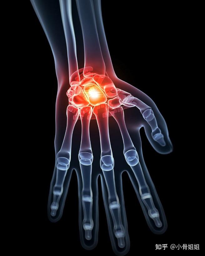 电竞医疗兴起：专治